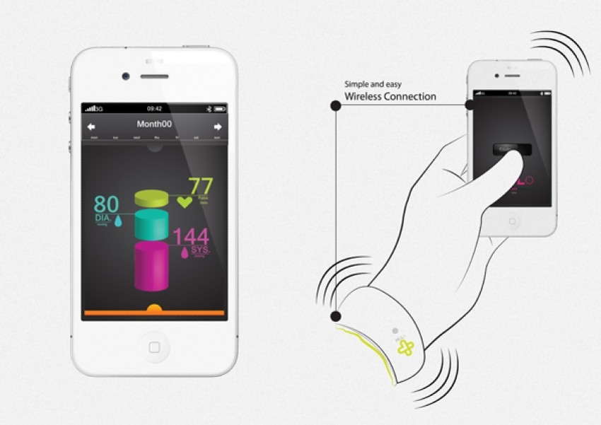 Aplikacija za smartphone otkriva fibrilaciju atrija