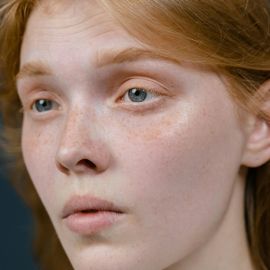 Sveti gral u posjetljivajnu kože - MBR Skin Lightening serum