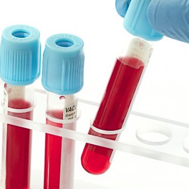 Laboratorijske pretrage