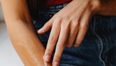 Koža sklona ekcemima